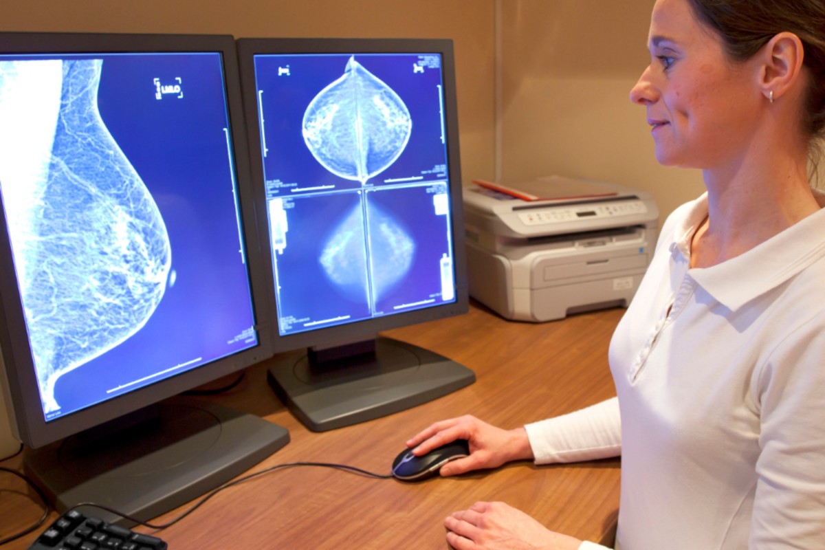 Análisis de mamografías.